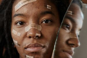 Skin Treatment in Chandigarh – Advanced Skin Care Clinic | Laser Dermix